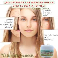 Crema La Tía Mána | Original | 39g | Anti-acne | Anti-paño