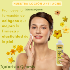 Loción Anti Acne | 225ml | De Azufre | Espinillas | Barros